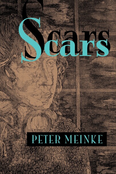 Scars